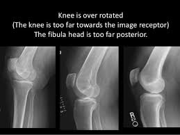 Pin On Xray