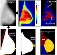 Lee 11 breast anatomy introduction understanding breast anatomy is important to recognizing the disease processes that may occur within the breast. Incorporating Breast Anatomy In Computational Phenotyping Of Mammographic Parenchymal Patterns For Breast Cancer Risk Estimation Scientific Reports