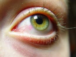 How To Fix Puffy Eyes After Crying Eye Art Eye Close Up Art Reference Photos