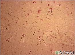 Image result for yersinia fotos