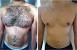 Male Hair Removal Cream