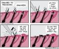 What Do Ingrown Hairs Look Like In Pubic Area