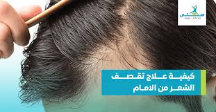 أسباب و كيفية علاج تقصف الشعر من الأمام نهائيا صحتي