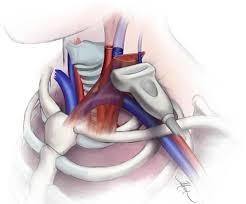 The neck is supplied by arteries other than the carotids. Pains In The Neck Emergency Physicians Monthly