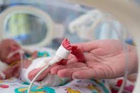 Bayi pramatang, dilahirkan lewat 17 hari dari kembarnya, mempunyai peluang tipis untuk hidup, namun kini sihat dan normal seperti bayi lain. Bayi Pramatang 9 Faktor Penyebab Kelahiran Pramatang Theasianparent Malaysia
