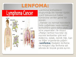 Hodgkin lenfoma ( hl ) bir tür lenfoma ki burada kanser belirli bir türünden kaynaklanır beyaz kan hücreleri olarak adlandırılan lenfositler. Non Hodgkin Lenfoma Nhl Lenfatik Sistem O Lenfatik Sistem Lenfatik Sistem Vucut Savunma Sisteminin Bir Parcasidir O Vucudun Hastalik Ve Enfeksiyonlardan Ppt Indir