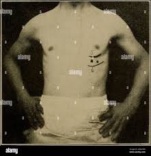 Image result for Point of Maximum Impulse