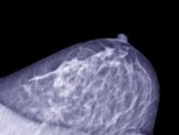 Apbi targets a high dose of radiation only on or near the area where. Clinical Trial Shows Reduction In Long Term Radiotherapy Side Effects In Women With Breast Cancer Ecancer