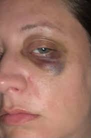 Tattoo Artist Arrested in Ohio for Malpractice and Theft