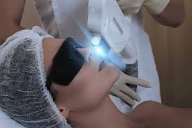 Leave a reply cancel reply. What Are The Main Differences Between Ipl And Laser Hair Removal Dermagical London