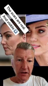 Kate Middleton After The Death of Thomas Kingston