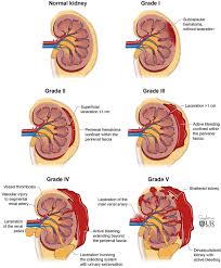 Image result for Genitourinary Trauma