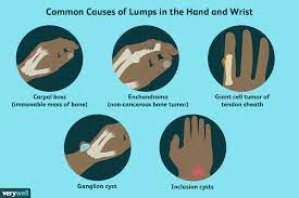 We define soft skills as abilities not unique to any job. Causes Of Lumps And Bumps On The Hands And Wrists