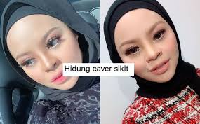 We did not find results for: Dah Allah Bagi Nak Saya Tukar Ke Baru Tak Hina Saya Gara Gara Hidung Siti Sarah Terpaksa Tanggung Derita 30 Tahun Gempak