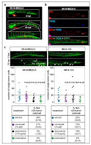 We did not find results for: Pharmaceuticals Free Full Text Rapid In Vivo Validation Of Hdac Inhibitor Based Treatments In Neuroblastoma Zebrafish Xenografts Html