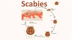 Image result for Sarcoptes scabiei life cycle
