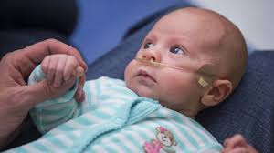 Serotonin Signaling and Neonatal Bronchopulmonary Dysplasia