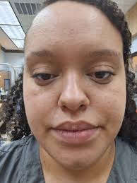 Affordable products for red, bumpy, dry skin?