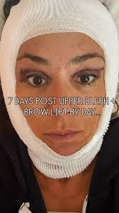 Part One of My Post Surgery Journey I've never been this vulnerable but  feel we need more of this and as a leader- I must… I've always believed in  keeping it real