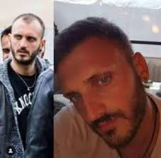 +1000€ · autotrapianto capelli + sopracciglia: Trapianto Dei Capelli Un Business Dalla Turchia Alla Puglia Corriere It