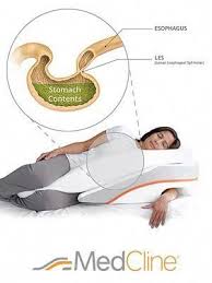 Pin On Acid Reflux Symptoms And Remedies