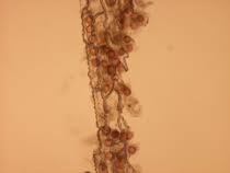 Image result for Pycnospora