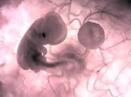 Start studying introduction to obstetric scanning. Dating And Viability Scan Canberra Fetal Assessment Centre