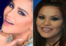 أوضح الناقد الفني طارق الشناوي أنه متأكد من تراجع المطربة آمال ماهر عن قرار اعتزالها الغناء، كما أعلنت قبل أيام.وخلال مداخلة هاتفية مع الإعلامي خيري رمضان، والإعلامية كريمة عوض في برنامج حديث القاهرة على قناة. Ø¨Ø§Ù„ØµÙˆØ± Ø´ÙƒÙ„ Ø§Ù„Ù†Ø¬Ù…Ø§Øª Ù‚Ø¨Ù„ ÙˆØ¨Ø¹Ø¯ Ø¹Ù…Ù„ÙŠØ§Øª ØªØ¬Ù…ÙŠÙ„ Ø§Ù„Ø£Ø³Ù†Ø§Ù†