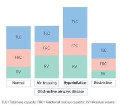 Image result for Functional Residual Capacity