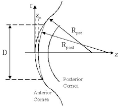 We know 7 definitions for lasik abbreviation or acronym in 1 categories. Optics Of Refractive Surgery