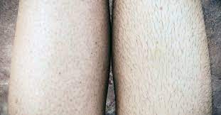 It also soothes the irritation of the razor bumps. How To Get Rid Of Strawberry Legs Treatment And Prevention