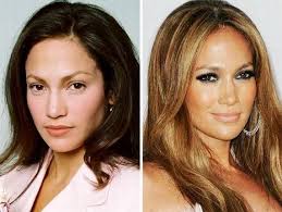 Jennifer Lopez Plastic Surgery Procedures Celebrity Plastic Surgery Hair Implants Jennifer Aniston Nose