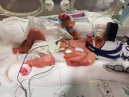 Hospital provides a world renowned ophthalmic service not only to the local community of liverpool, it also services regional, national and global referrals to the highly trained and dedicated. Nsw S Tiniest Babies Beat The Premature Birth Survival Odds Daily Telegraph