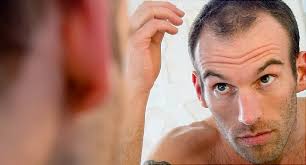We all make quick judgments about each other based on our looks and the one thing we can't hide is our face. Men S Hair Loss Treatments And Solutions With Pictures