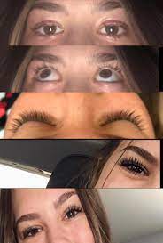 But will the eyelashes grow back faster if a person uses home remedies to treat lost lashes? Please Help Eyelashes Ripped Out Eyelash Extensions Got Ripped Out And Took My Natural Eyelashes With Them Top 2 Pics Are After They Ve Been Ripped Out Bottom 3 Before Are They Gonna