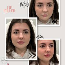 DESIREE MOSER, RN (@injector_desiree) • Instagram फोटोहरू र भिडियोहरू