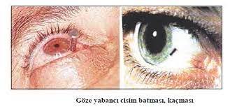 Her Sey Saglik Icin 2016