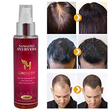 It's called androgenetic alopecia, or female (or male) pattern hair loss. H Growth Hair Regrowth Oil The Best Natural Hair Growth Oil Anti Hair Fall Formula Stop Hair Fall For Natural Hair Growth Oil Hair Regrowth Oils Hair Regrowth