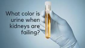 Image result