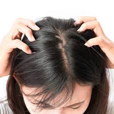 There are many reasons excessive hair loss may occur. How To Treat Scalp Zits According To Experts Brit Co