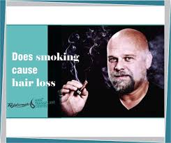 If the male members of your family went bald in their youth then there is a good chance that you will do there are other causes of hair loss but male pattern baldness is especially common. Does Smoking Cause Hair Loss Hair Transplant Centre