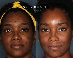 Every journey starts with the decision to try 💪 . Take advantage of a💰  FREE💰 Skin Consultation when you purchase your Pigment Correcting kit