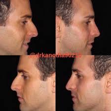 Reviews Dr. Raj Kanodia Medical Group (Plastic Surgery) in California