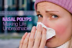 According to the research findings, chronic inflammation is defined as any inflammation that persists for a period of 12 weeks or longer. 7 Best Homeopathic Medicines For Nasal Polyps