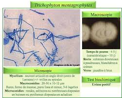 Trichophyton Mentagrophytes Biochimique Medical Biologie