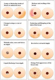 Some skin changes of the breast raise concern for cancer. The Physical Changes Of Breast Download Scientific Diagram