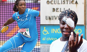 Professor osakue is currently working on two projects: Her Crime She Is Black Italian Born Nigerian Athlete Daisy Osakue Attacked With Egg In Italy Suffers Eye Injury