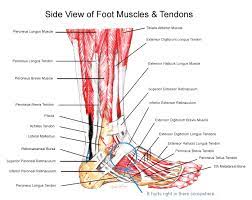 Tendonitis