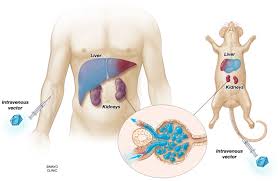 Improving Molecular Therapy In The Kidney Springerlink We have wide range of cartoons and anime that you can watch in hd and high quality for free. improving molecular therapy in the