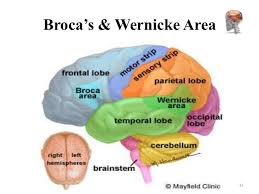 Resultat d'imatges de area de wernicke